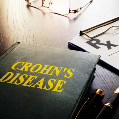 Warning signs of Crohn’s disease